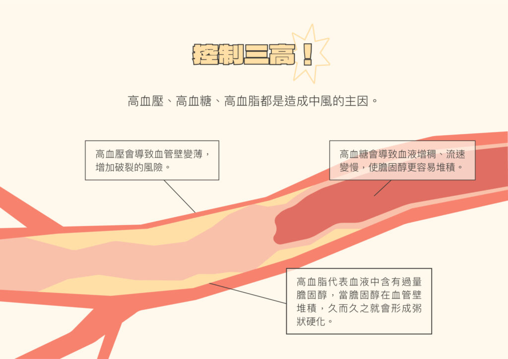 我又中風啦!為什麼要說「又」呢?二度中風|Home心中風懶人包 5 4 3